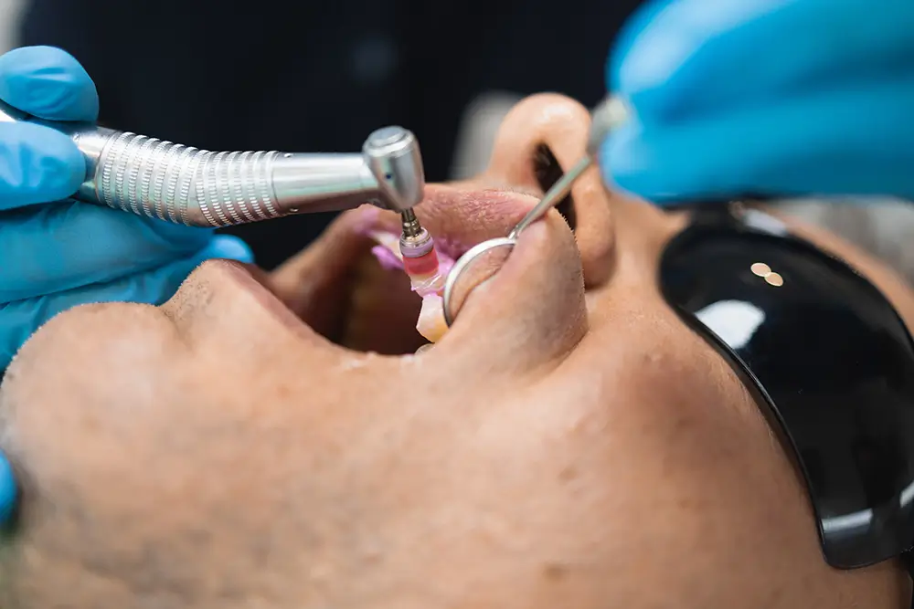 Regenerative Endodontics Treatment in I-8 Markaz, Islamabad | Oracare Dentistry